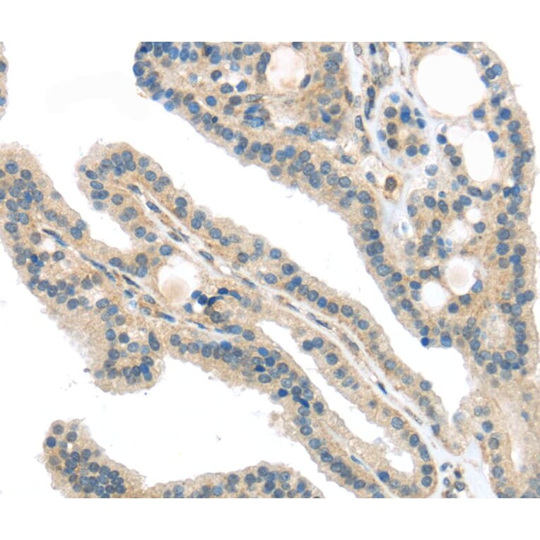Immunohistochemistry - VPS26A Antibody from Signalway Antibody (40295) - Antibodies.com
