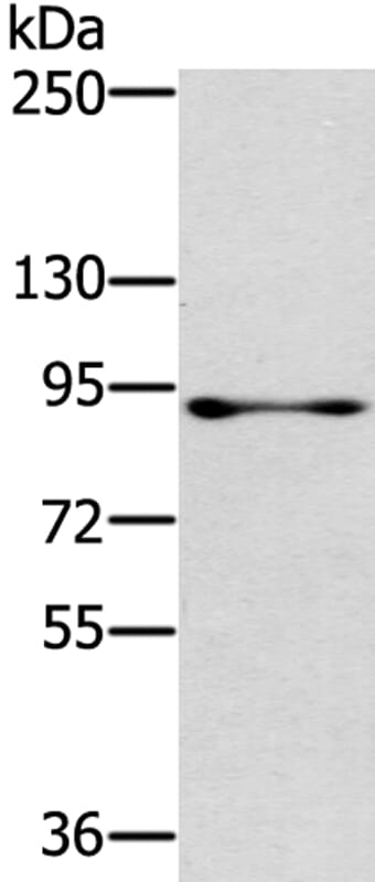 Gel: 6%SDS-PAGE Lysate: 40ug 231 cell. Primary antibody: 1/300 dilution Secondary antibody dilution: 1/8000Exposure time: 2 minutes