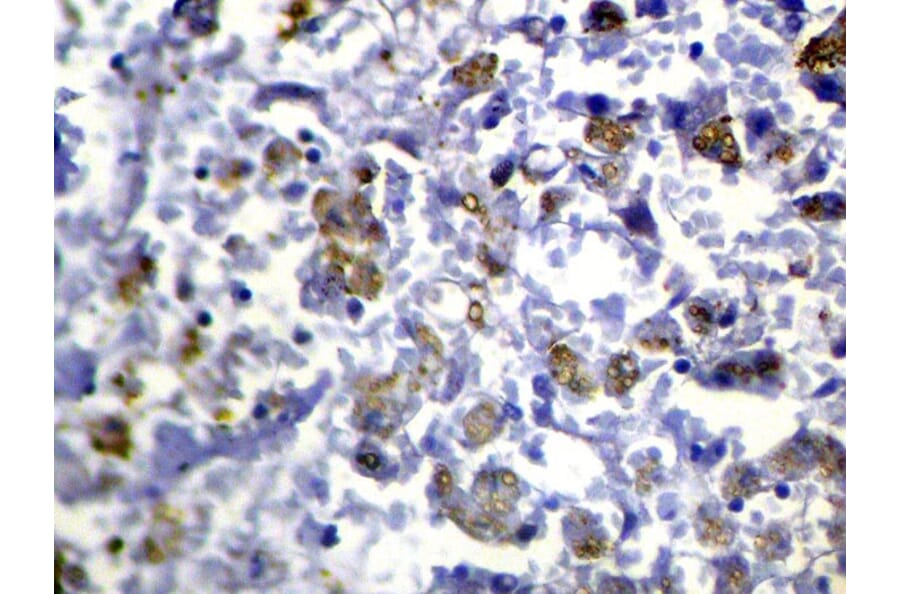 Immunohistochemistry - RASAL1 Antibody from Signalway Antibody (40316) - Antibodies.com