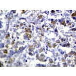 Immunohistochemistry - RASAL1 Antibody from Signalway Antibody (40316) - Antibodies.com