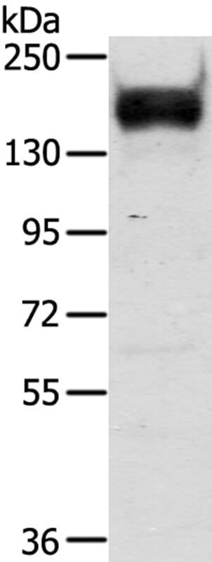 Gel: 6%SDS-PAGE Lysate: 40ug Mouse brain tissue. Primary antibody: 1/400 dilution Secondary antibody dilution: 1/8000Exposure time: 20 seconds