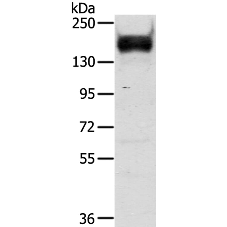 RASAL2 Antibody from Signalway Antibody (40317) - Antibodies.com