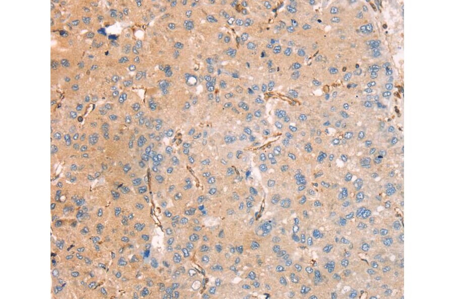 Immunohistochemistry - RASAL2 Antibody from Signalway Antibody (40317) - Antibodies.com