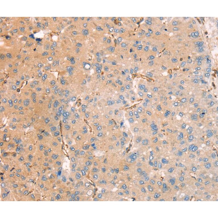 Immunohistochemistry - RASAL2 Antibody from Signalway Antibody (40317) - Antibodies.com