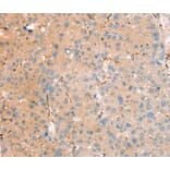 Immunohistochemistry - RASAL2 Antibody from Signalway Antibody (40317) - Antibodies.com