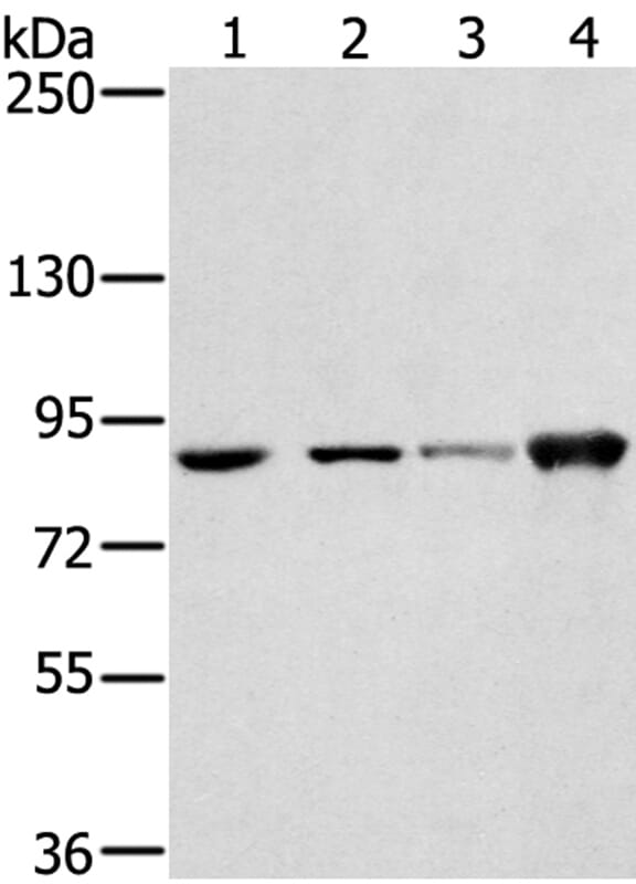 Gel: 6%SDS-PAGE Lysates (from left to right): 823, PC3, 231 and hepg2 cell. Amount of lysate: 40ug per lane Primary antibody: 1/250 dilution Secondary antibody dilution: 1/8000Exposure time: 20 seconds