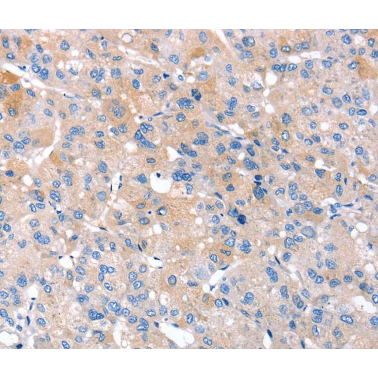 Immunohistochemistry - RNF214 Antibody from Signalway Antibody (40325) - Antibodies.com