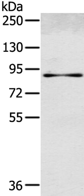 Gel: 6%SDS-PAGE Lysate: 40ug Human normal colon tissue. Primary antibody: 1/600 dilution Secondary antibody dilution: 1/8000Exposure time: 5 seconds
