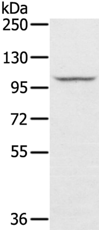 Gel: 6%SDS-PAGE Lysate: 0ug A549 cell. Primary antibody: 1/250 dilution Secondary antibody dilution: 1/8000Exposure time: 10 seconds