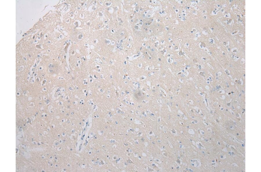Immunohistochemistry - STARD8 Antibody from Signalway Antibody (40340) - Antibodies.com