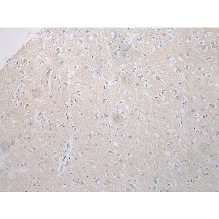 Immunohistochemistry - STARD8 Antibody from Signalway Antibody (40340) - Antibodies.com