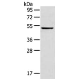TRIM49 Antibody from Signalway Antibody (40344) - Antibodies.com