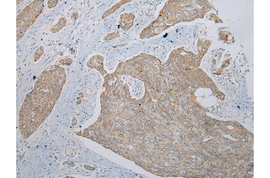 Immunohistochemistry - TRIM49 Antibody from Signalway Antibody (40344) - Antibodies.com