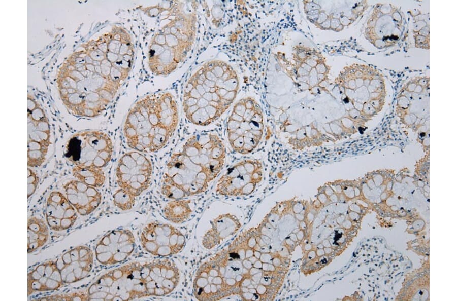 Immunohistochemistry - TRIM49 Antibody from Signalway Antibody (40344) - Antibodies.com