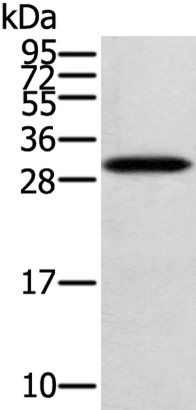 Gel: 12% SDS-PAGE Lysate: 40ug Human fetal brain tissue. Primary antibody: 1/400 dilution Secondary antibody dilution: 1/8000Exposure time: 2 minutes