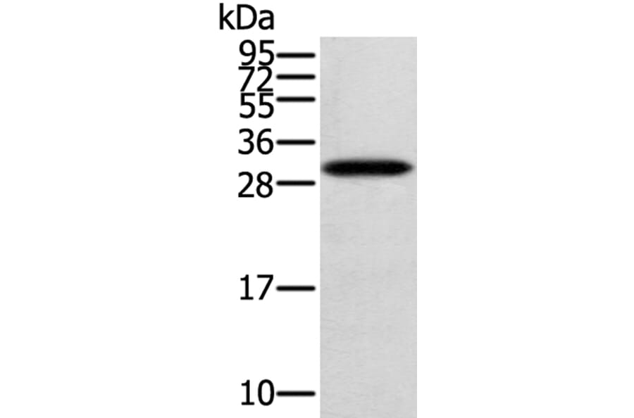 STARD5 Antibody from Signalway Antibody (40375) - Antibodies.com