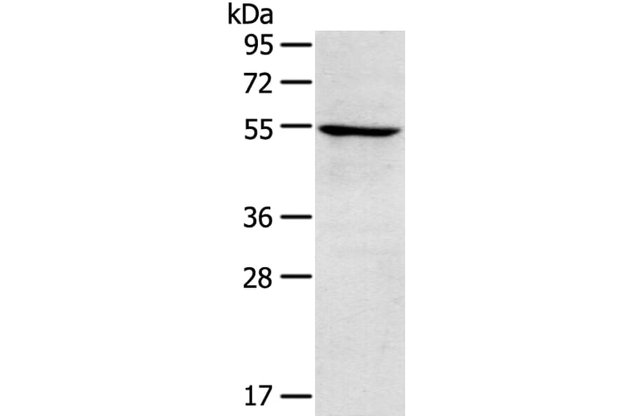 TRIM22 Antibody from Signalway Antibody (40381) - Antibodies.com
