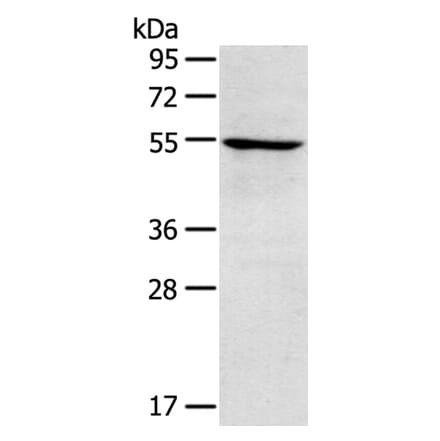 TRIM22 Antibody from Signalway Antibody (40381) - Antibodies.com