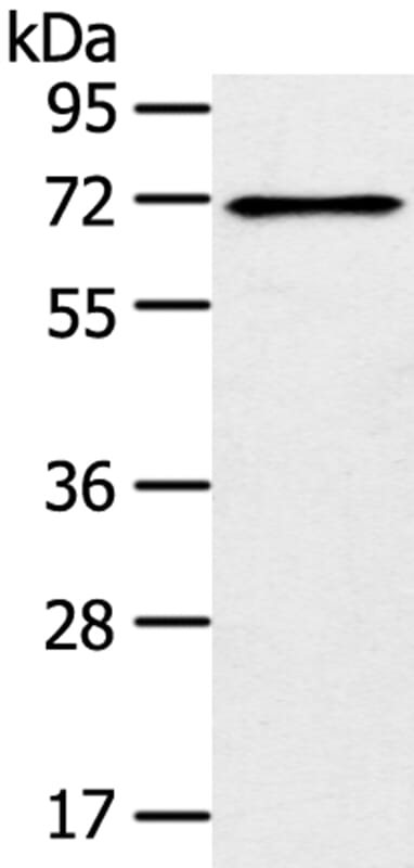 Gel: 8% SDS-PAGE Lysate: 40ug 293T cell. Primary antibody: 1/300 dilution Secondary antibody dilution: 1/8000Exposure time: 1 minute