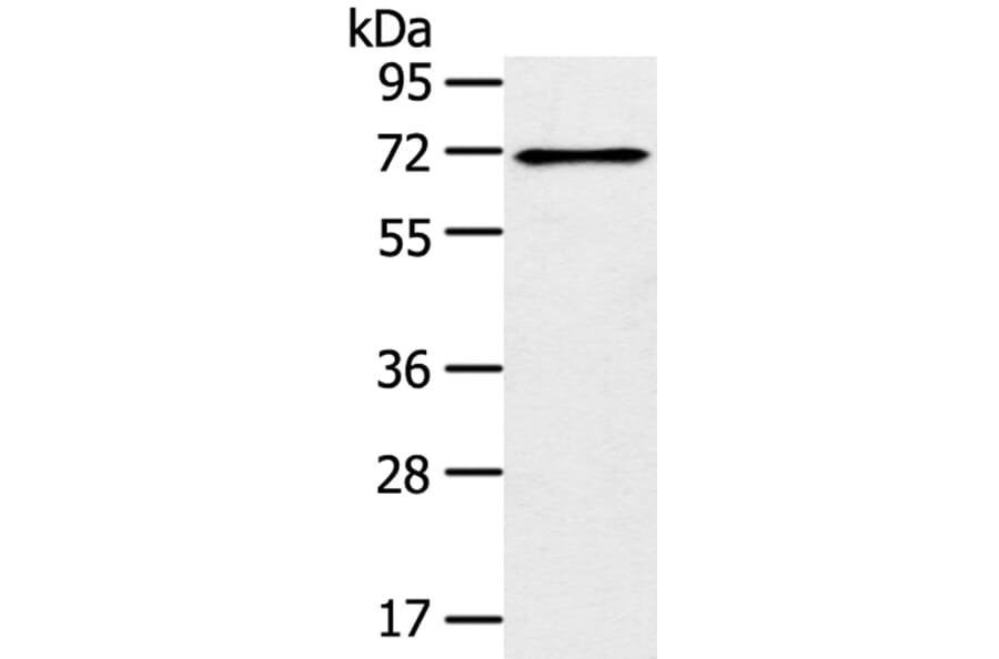 TRIM47 Antibody from Signalway Antibody (40392) - Antibodies.com