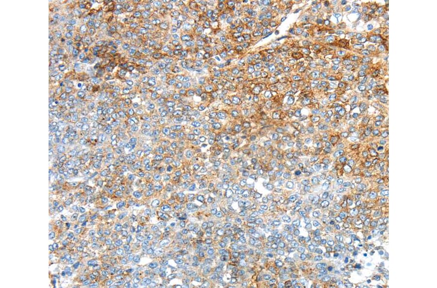 Immunohistochemistry - TRIM47 Antibody from Signalway Antibody (40392) - Antibodies.com