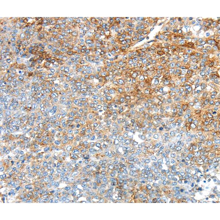 Immunohistochemistry - TRIM47 Antibody from Signalway Antibody (40392) - Antibodies.com