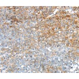 Immunohistochemistry - TRIM47 Antibody from Signalway Antibody (40392) - Antibodies.com