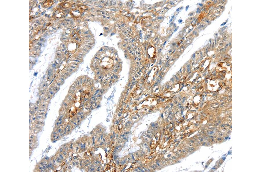 Immunohistochemistry - TRIM47 Antibody from Signalway Antibody (40392) - Antibodies.com