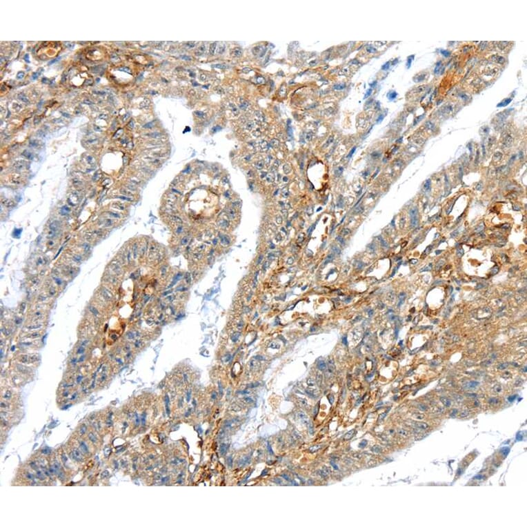 Immunohistochemistry - TRIM47 Antibody from Signalway Antibody (40392) - Antibodies.com