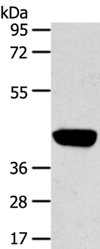 Gel: 8% SDS-PAGE Lysate: 40ug Hepg2 cell. Primary antibody: 1/450 dilution Secondary antibody dilution: 1/8000Exposure time: 3 minutes