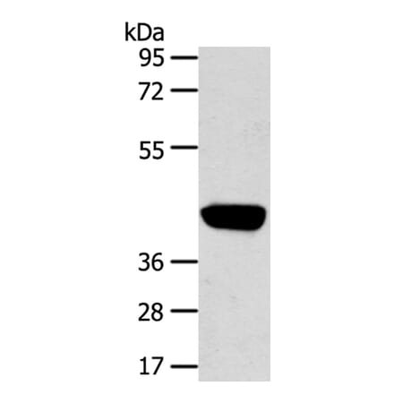 PRSS50 Antibody from Signalway Antibody (40393) - Antibodies.com