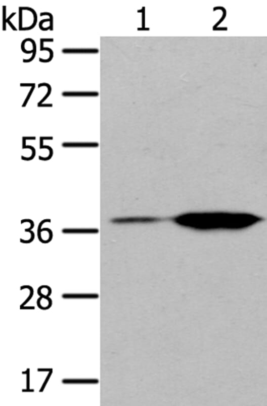 Gel: 8% SDS-PAGE Lysates (from left to right): Raji and Jurkat cell. Amount of lysate: 40ug per lane Primary antibody: 1/200 dilution Secondary antibody dilution: 1/8000Exposure time: 40 seconds