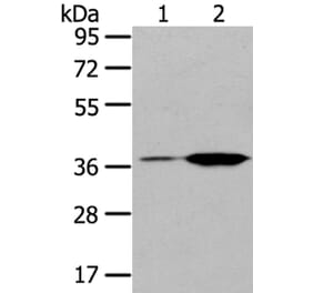 TBXA2R Antibody from Signalway Antibody (40396) - Antibodies.com