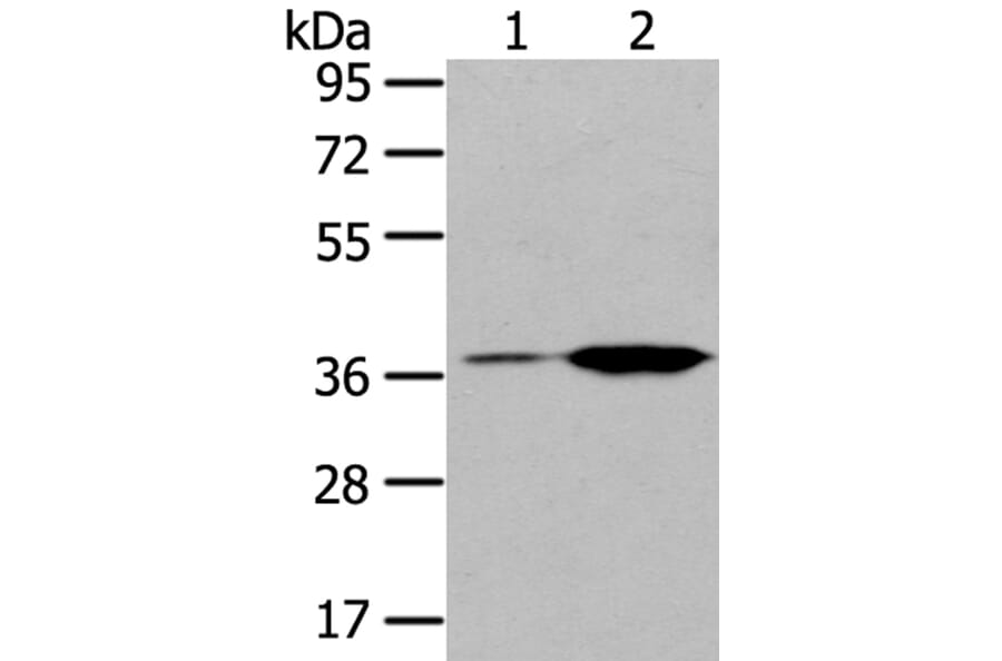 TBXA2R Antibody from Signalway Antibody (40396) - Antibodies.com