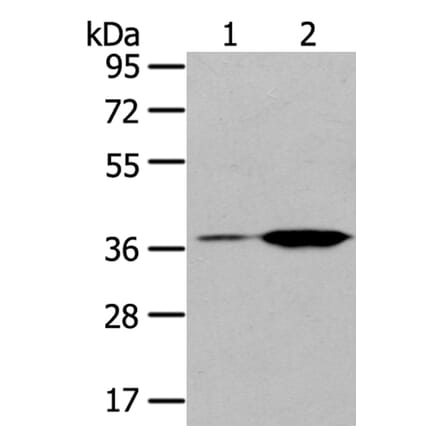 TBXA2R Antibody from Signalway Antibody (40396) - Antibodies.com