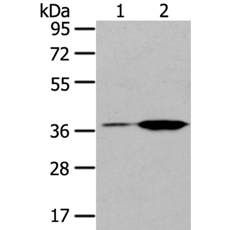 TBXA2R Antibody from Signalway Antibody (40396) - Antibodies.com