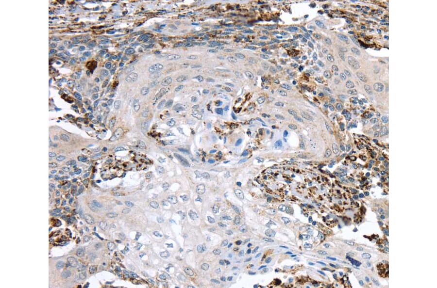 Immunohistochemistry - TBXA2R Antibody from Signalway Antibody (40396) - Antibodies.com