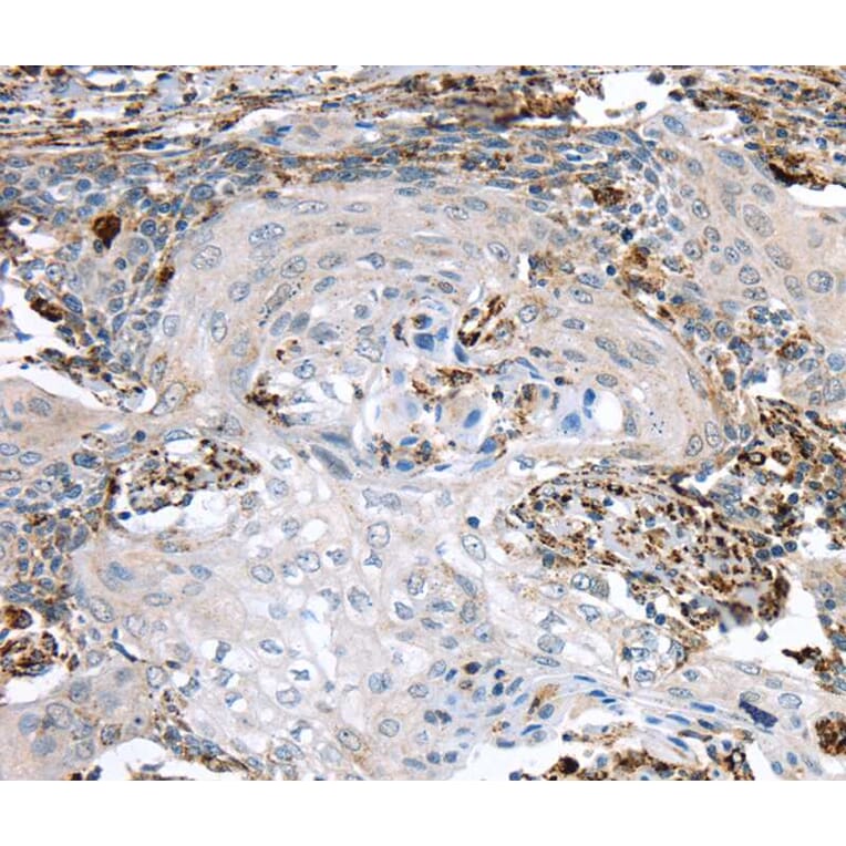 Immunohistochemistry - TBXA2R Antibody from Signalway Antibody (40396) - Antibodies.com