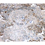 Immunohistochemistry - TBXA2R Antibody from Signalway Antibody (40396) - Antibodies.com