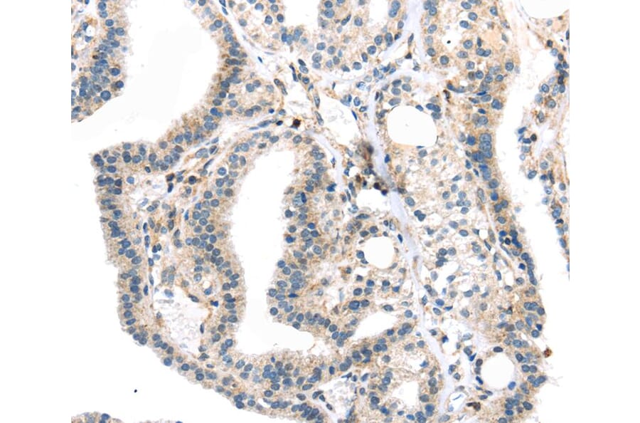 Immunohistochemistry - TBXA2R Antibody from Signalway Antibody (40396) - Antibodies.com