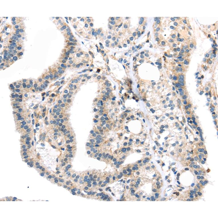 Immunohistochemistry - TBXA2R Antibody from Signalway Antibody (40396) - Antibodies.com