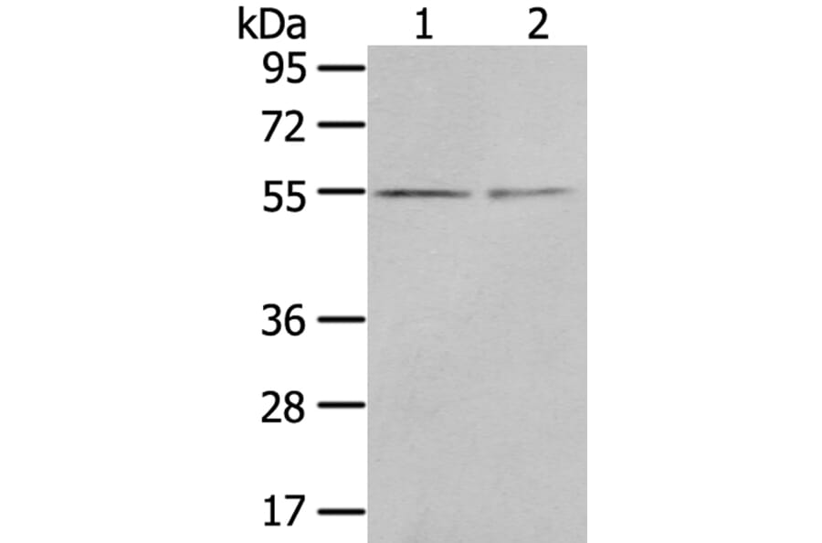 CHRDL1 Antibody from Signalway Antibody (40398) - Antibodies.com