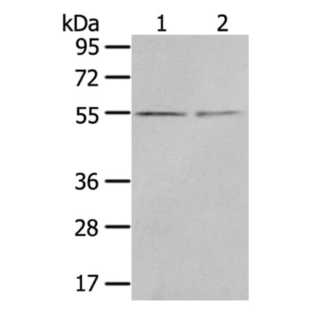 CHRDL1 Antibody from Signalway Antibody (40398) - Antibodies.com