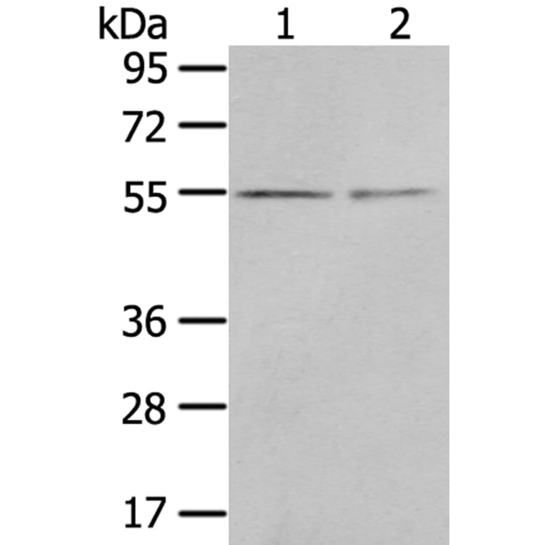 CHRDL1 Antibody from Signalway Antibody (40398) - Antibodies.com