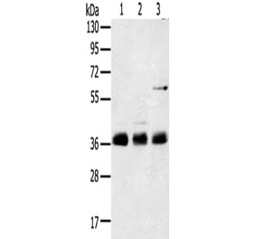 ANKRD1 Antibody from Signalway Antibody (42714) - Antibodies.com