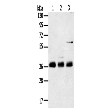 ANKRD1 Antibody from Signalway Antibody (42714) - Antibodies.com