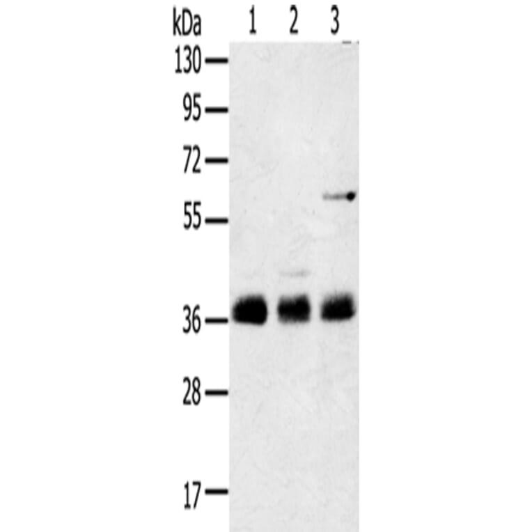 ANKRD1 Antibody from Signalway Antibody (42714) - Antibodies.com