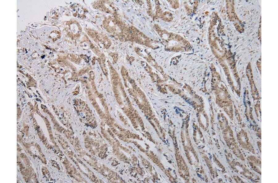 Immunohistochemistry - ANKRD1 Antibody from Signalway Antibody (42714) - Antibodies.com
