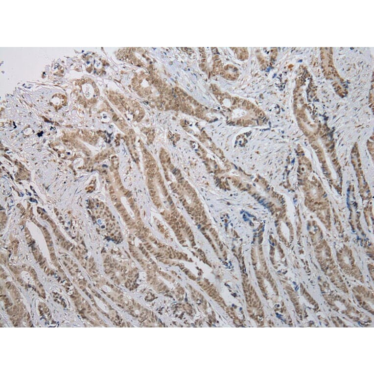 Immunohistochemistry - ANKRD1 Antibody from Signalway Antibody (42714) - Antibodies.com