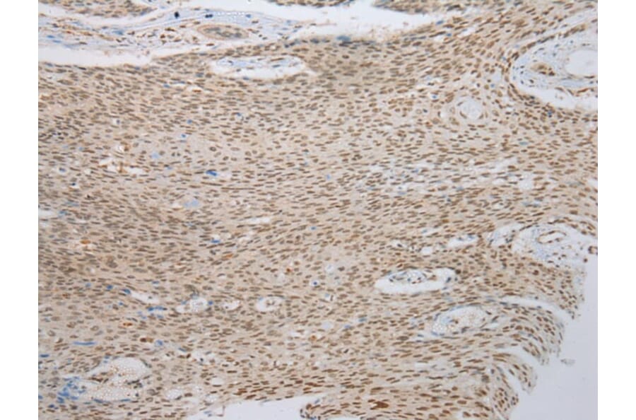 Immunohistochemistry - ANKRD1 Antibody from Signalway Antibody (42714) - Antibodies.com
